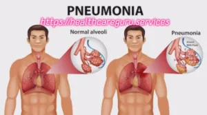 प्न्यूमोनिया-Pneumonia